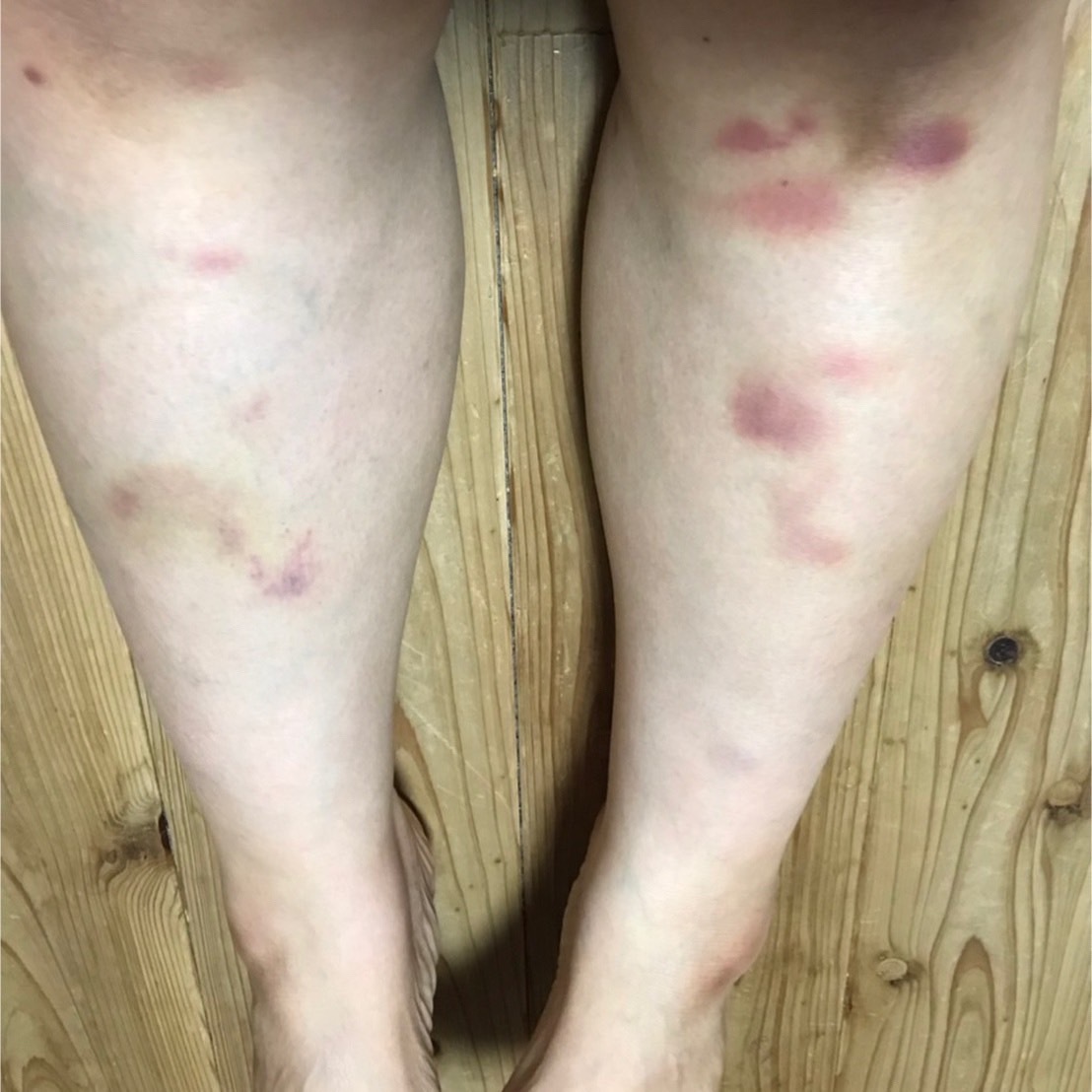 ブログ オンズ Indiba Salon Onz Eparkリラク エステ