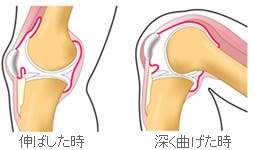 椅子から立つと膝が痛い その原因と対策は 19年05月06日 時10分 整体院 Oasisブログ Eparkリラク エステ