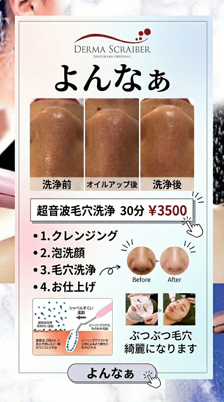 超音波毛穴洗浄(2026年05月13日 17時18分) よんなぁブログ | EPARK