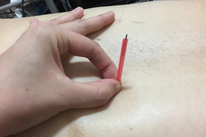 南千住駅前整骨院・鍼灸院