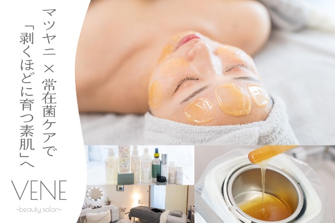 VENE -beauty salon-【ウェヌ】/マツヤニ肌質改善サロン